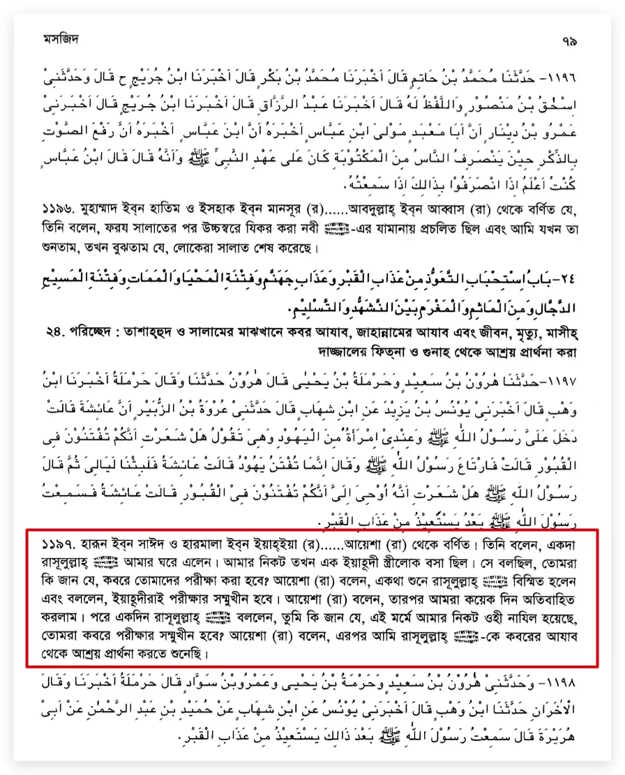 15.কবরের আজাব সম্পর্কে বিস্ময়
